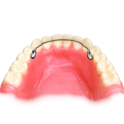 Preformed Bondable Lingual Retainers